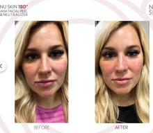 Load image into Gallery viewer, Peel Pads